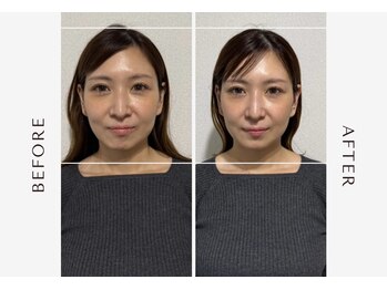 アンドブレインビューティー(and.Brain Beauty)