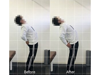 整体院 ナル(Nalu)の写真/デスクワークや立ち仕事での首肩こり・腰痛をケア！姿勢矯正、可動域改善で快適な体へ♪