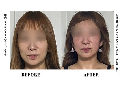 コアサロン(58SALON)の写真