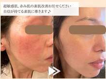 レイテノール 藤沢店