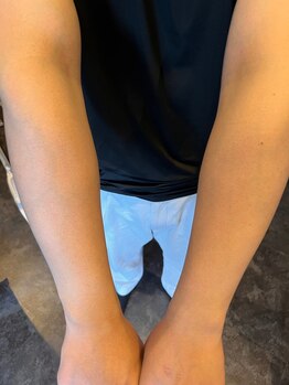 ディオラビューティーサロン(Diora)/田川脱毛/飯塚/眉毛/まゆげ/