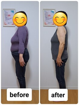 プルクラ プラス(PULCHRA)/耳ツボ施術での変化