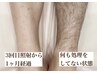 【メンズ新規限定！】ヒゲ・両脚・両腕から選べる人気部位が1パーツ¥3,000♪