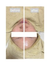 トランク(Trunk)/プラズマ♪before→after