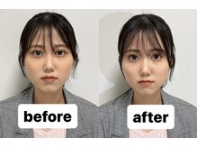 ミルク 学芸大学(MILK)/お客様before→after