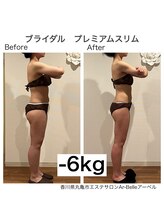 アーベル(Ar-Belle)/ブライダルエステBefore after