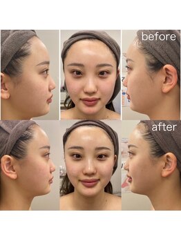 プロラボスパ 渋谷店/20代後半　症例写真