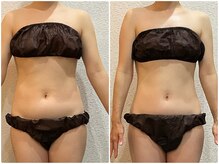 美容整体 ウェリナ 蟹江院/小顔矯正/骨盤矯正/美脚サロン