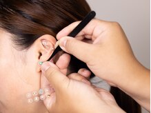 はせがわ鍼灸整骨院/耳つぼジュエリー