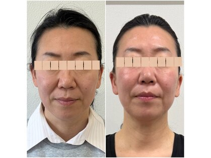 エイジングケアサロンシー(aging care salon cee)の写真