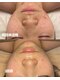 リルビー(Lilby)の写真/繰り返す肌悩みを、土台から整える肌質改善。