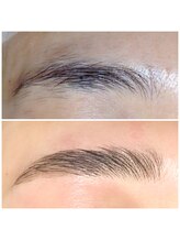 フォース(Force)/《HBL》ハリウッドブロウリフト