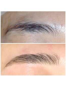 フォース(Force)/《HBL》ハリウッドブロウリフト