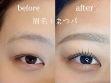 サリュウ 西新店(Salyu)/眉毛＋マツパ