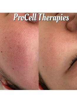 シエル(Ciel)/プロセルセラピーズフェイシャル