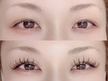 Q.フラットラッシュは何が違いますか？