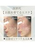 【大人気！】’’隠す’’から魅せる肌へ/肌質改善/ハーブピーリング¥9,900