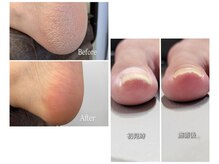 エヌ(enu.)の雰囲気（足裏角質・たこ・ウオノメ、巻き爪などフットケア登録サロンです）