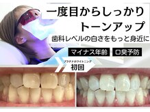 ベティー(Betee)