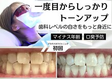 ベティー(Betee)