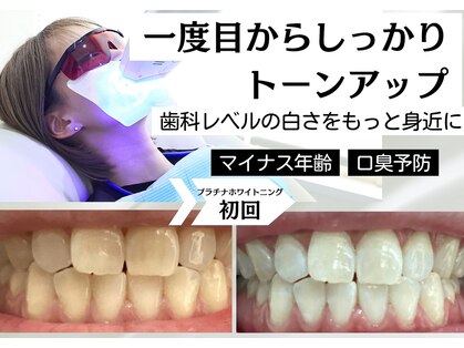 ベティー(Betee)の写真