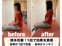 渋谷宮下パーク整体院 渋谷宮益坂整骨院/変化が1回でわかる！