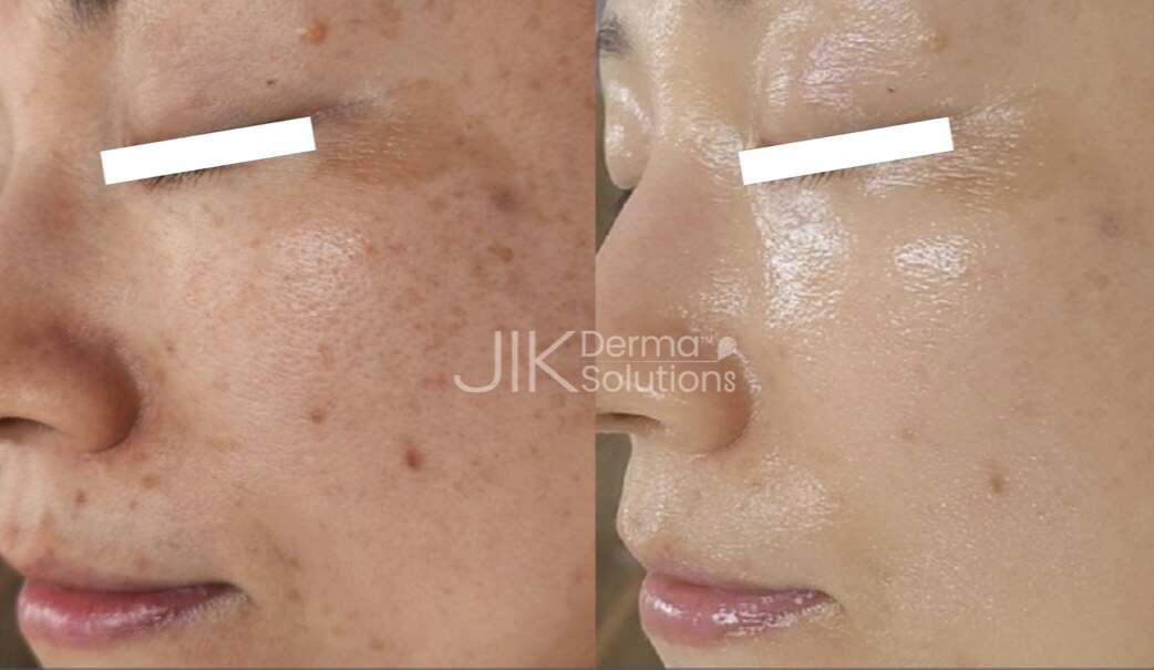 エン(O'en)｜ホットペッパービューティー