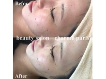 シャルムパリス(charme paris)の雰囲気（ずっと諦めていた肌もご相談ください#赤み#痒み#乾燥）