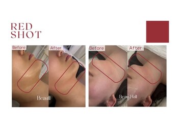 ピュールマロン ムッシュタロウ 桑名店(Pure Marron M.Taro)/【RED　SHOT】ビフォーアフター