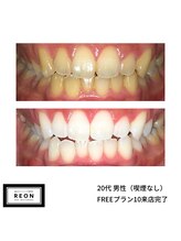 レオン 磐田(REON)/◇ お客様 before＆after ◇