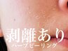NEW★【剥離あり】ハーブピーリング(アフターケア付き2回来店) 33,000円