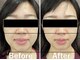 カンナ 福岡(Canna)の写真