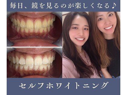 グリッター ショウナン(glitter.SHONAN)の写真