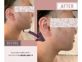 マーリエ(Malie)/【ラフォス】メンズ小顔