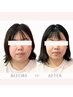 【フェイスラインすっきり・むくみ改善】小顔整体 初回体験 ¥9,000⇒