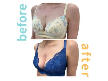 シエル(Ciel)/バストアップ施術１回目→７回