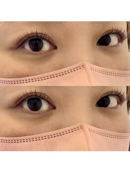 イユー(yeu)/&Healthy