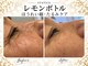 スターティス 麻布十番店(STATICE)の写真/【脂肪分解☆レモンボトル導入店】レモンボトル×小顔矯正同時施術でタイパ◎忙しい方におすすめ！
