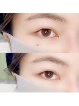 ルピナス 武蔵小金井店(Lupinus)/LEDフラットラッシュ140本