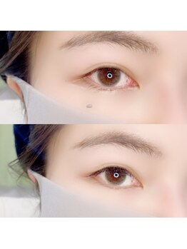 ルピナス 武蔵小金井店(Lupinus)/LEDフラットラッシュ140本