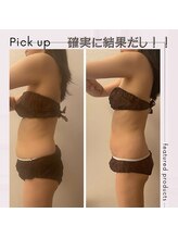 モゼ(moze)/ウルトラ痩身！背中／お腹