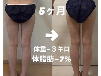 ヨサパーク ルポ(YOSA PARK ropos)/太もも引き締め【痩身/温活】