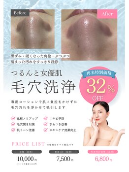 マイレ 平塚店(Maile)/毛穴吸引