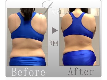 ステラ(STELLA)/上半身プレミアム3回の効果