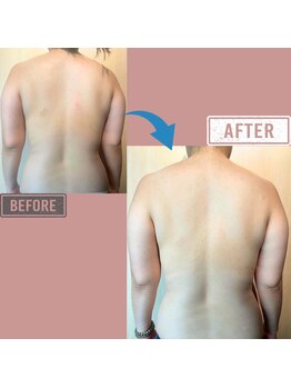 マーリエ(Malie)/【オールハンド】上半身５回施術