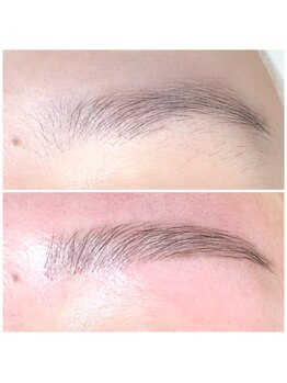 フォース(Force)/《HBL》ハリウッドブロウリフト