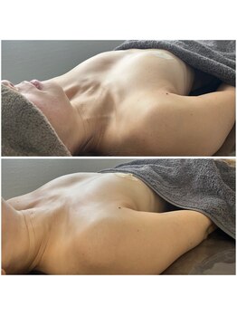 モア(moa)/40代もふっくらバスト