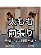 カワル整体 上通り院/姿勢で太もも張ります