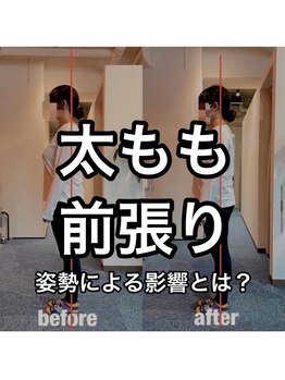 カワル整体 上通り院/姿勢で太もも張ります