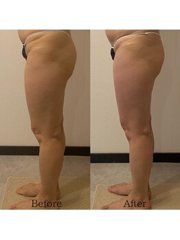 グランディール(GRANDIR)/【痩身】下半身コース10回